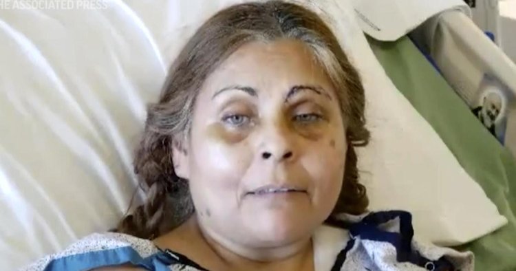 Pennsylvania factory explosion survivor said falling into chocolate vat saved her life