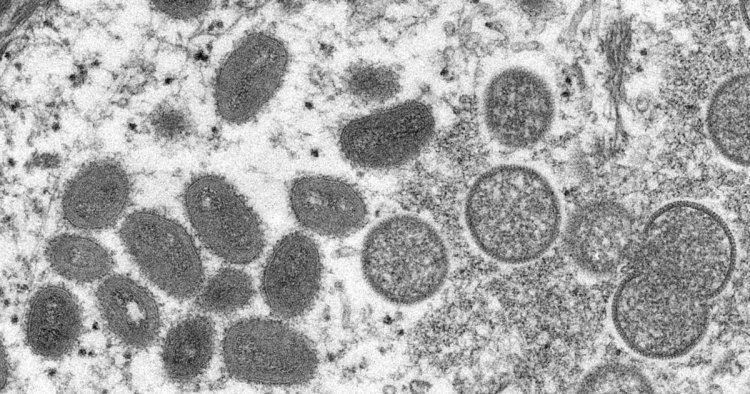 CDC investigating possible mpox resurgence amid dozens of new cases