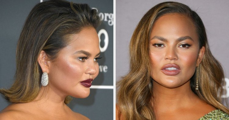 Chrissy Teigen Responded To A Follower Who Criticized Her "New Face"