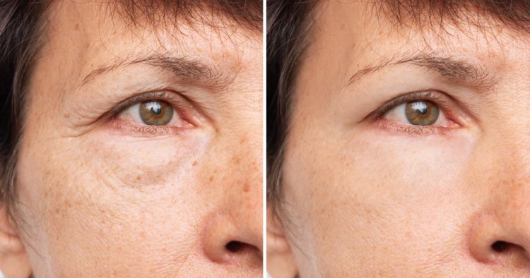 This Eye Cream May Get Rid of Puffiness and Wrinkles in Just 15 Minutes