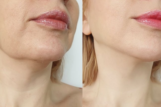 Shoppers Say This ‘Instant’ Lifting Cream Actually Does Work That Fast
