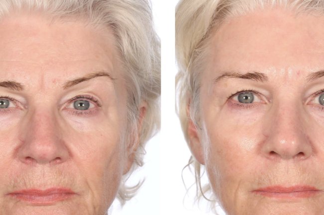 Serious Skincare’s Firming Treatment Makes You Look ‘15 Years Younger’