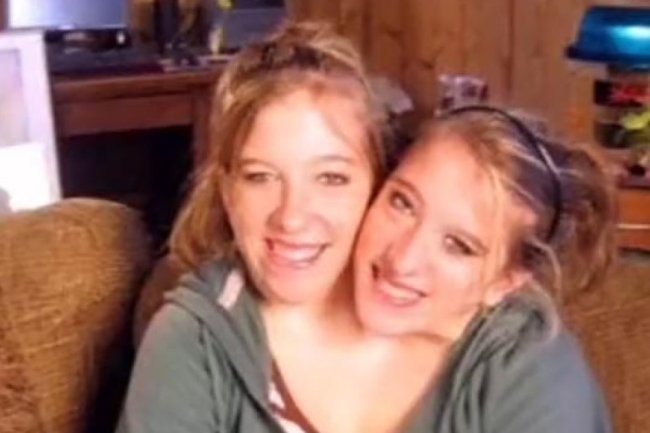 Conjoined Twin Abby Hensel Secretly Got Married 2 Years Ago: What to Know